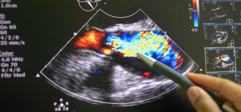 echocardiography veterinary